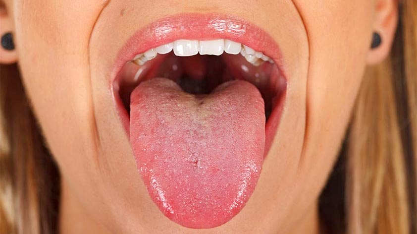 Your Tongue Your Health 3 Things to Look Out For Keep Fit Kingdom 842x472