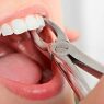 Tooth Decay: 5 Common Symptoms & Tips to Avoid It!