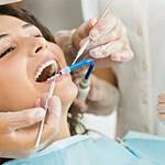 Tooth Extractions Everything You Need to Know KEEP FIT KINGDOM