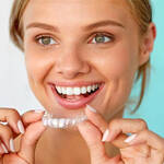 Invisalign Treatment Essential Points to Consider KEEP FIT KINGDOM
