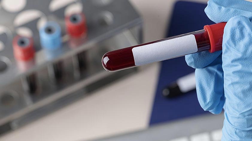 How Blood Testing Gives Athletes a Competitive Edge KEEP FIT KINGDOM