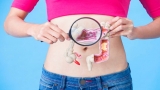 5 Steps to Fixing Poor Gut Health