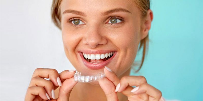 Invisalign Treatment: Essential Points to Consider