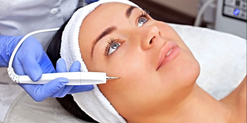 Is AGNES Acne Treatment Effective?