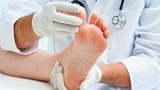 Why Do You See a Podiatrist When You Have Diabetes?