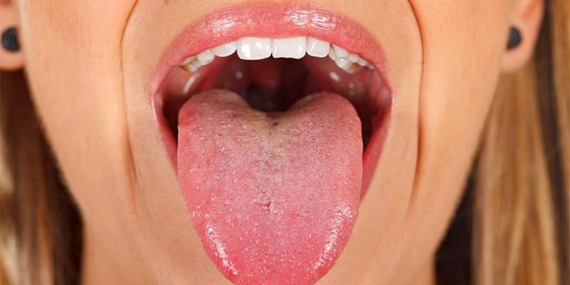 Your Tongue, Your Health: 3 Things to Look Out For!